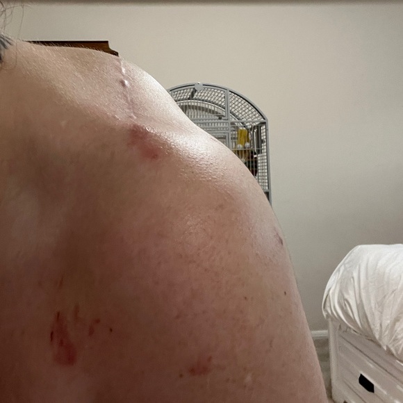 Waiting on next specialist🧿Malpractice Complications🧿 - Picture 3 of 11